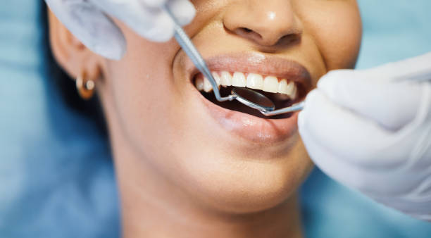 Best Emergency Wisdom Tooth Extraction in Brownstown, IN